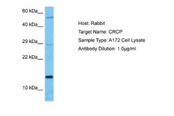 CRCP Rabbit anti-Human, Polyclonal, Novus Biologicals 0.1 mL | Buy Online | Novus Biologicals | Fisher Scientific